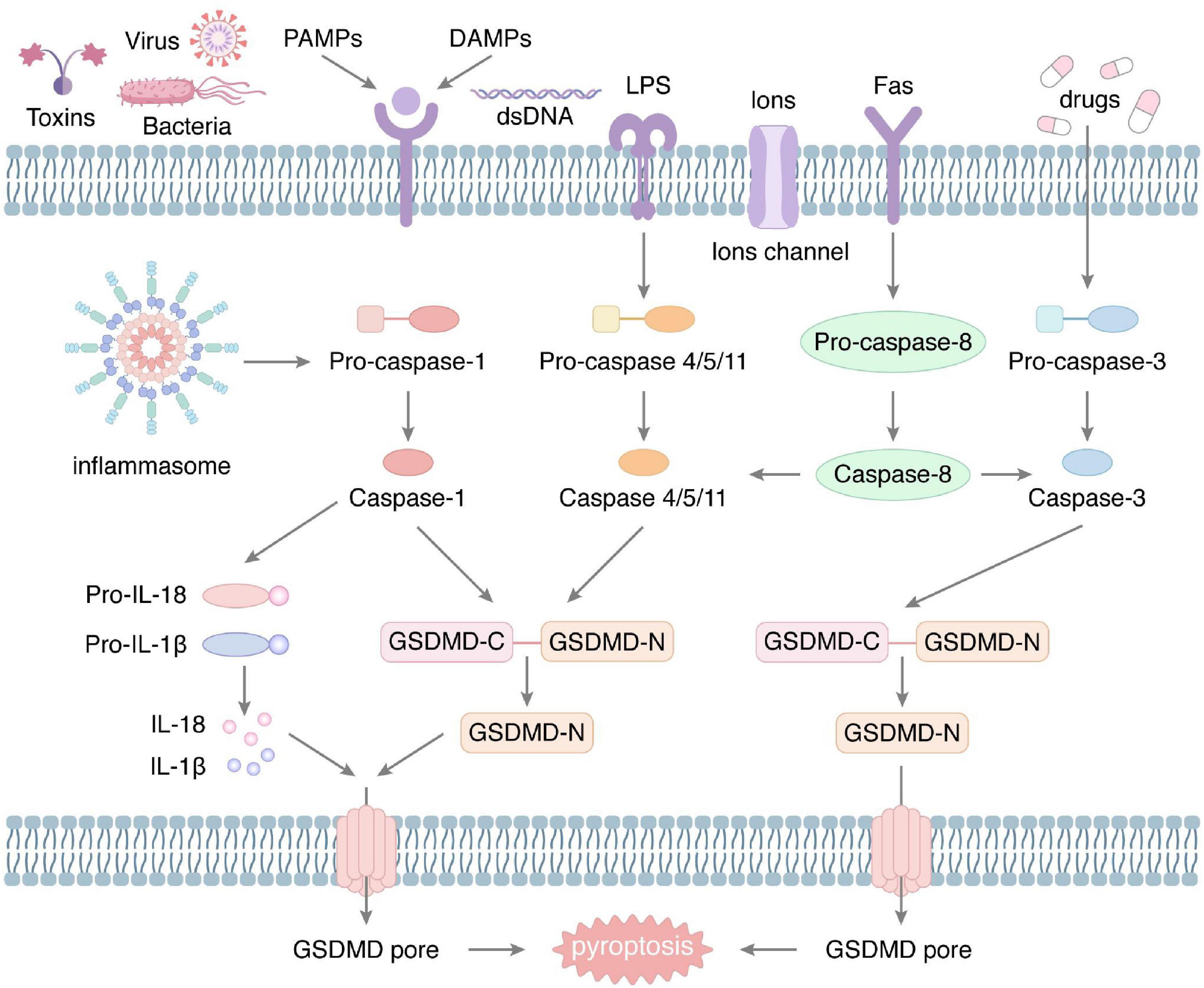 Relationship between pyroptosis-mediated inflammation and the pathogenesis of prostate disease